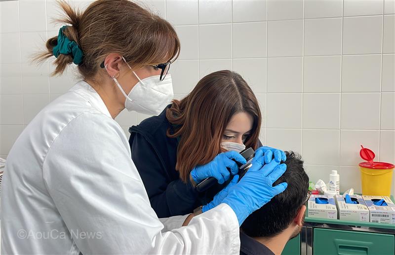 Alopecia areata day, consulti gratuiti al San Giovanni di Dio: venerdì 19 dicembre l’iniziativa a Cagliari
